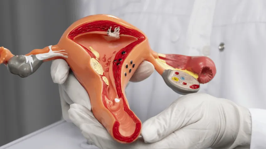 Bone Treatment